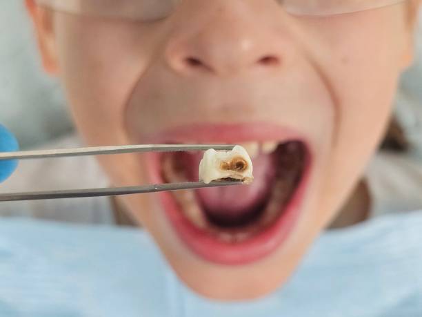 Best Emergency Treatment for Oral Infections in Brownsville, KY