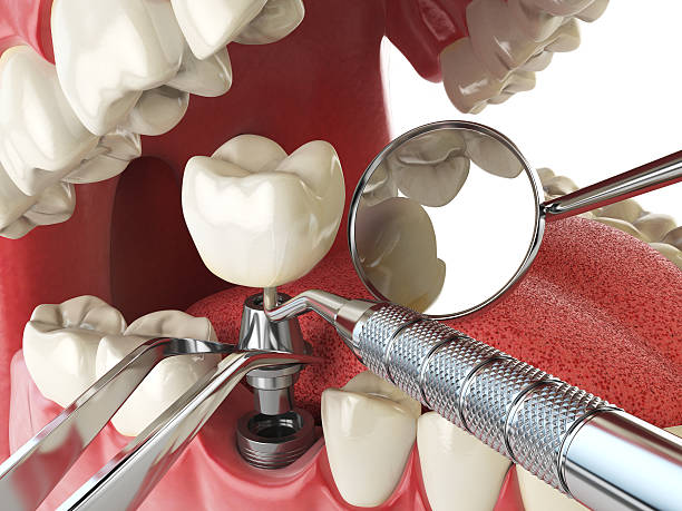 Best Emergency Dental Care for Sports Injuries in Brownsville, KY